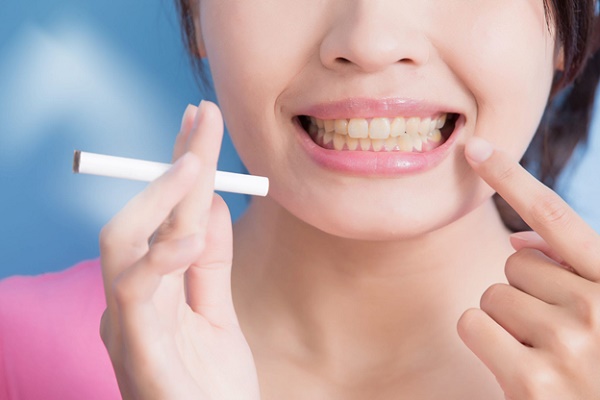 عوامل موثر زرد بودن دندان 
