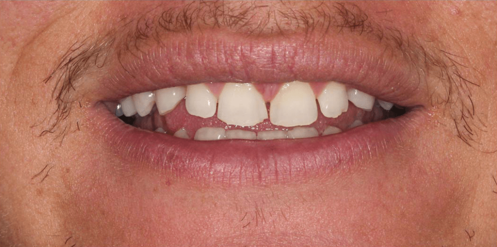 نمونه کار دندانپزشکی