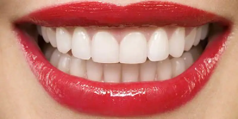  پروتز دندان فک بالا- کلیینک بام ایران